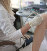 Varicose Veins When Should You Get a Venous Doppler Ultrasound