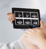 Early Pregnancy Bleeding When Do You Need an Ultrasoun
