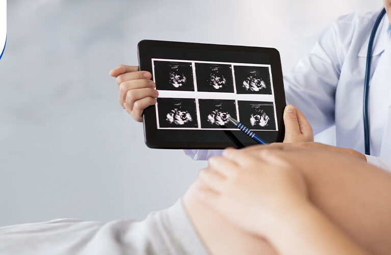 Early Pregnancy Bleeding When Do You Need an Ultrasoun