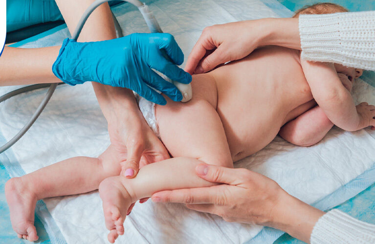 Hip Ultrasound for Babies Why It's Done and What Results Mean