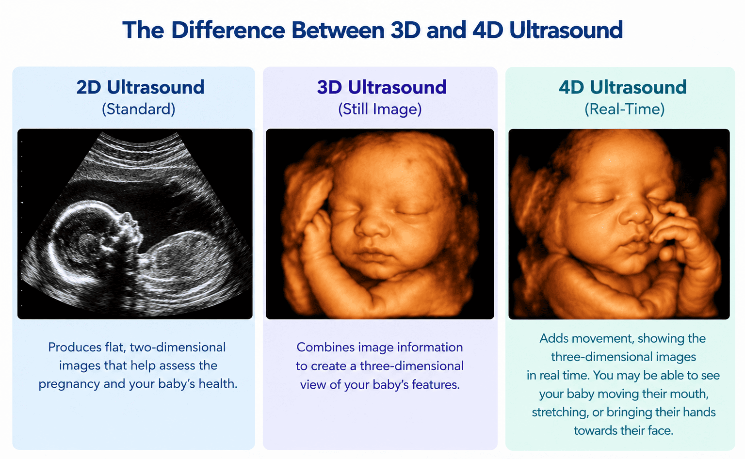 The Difference Between 3D and 4D Ultrasound